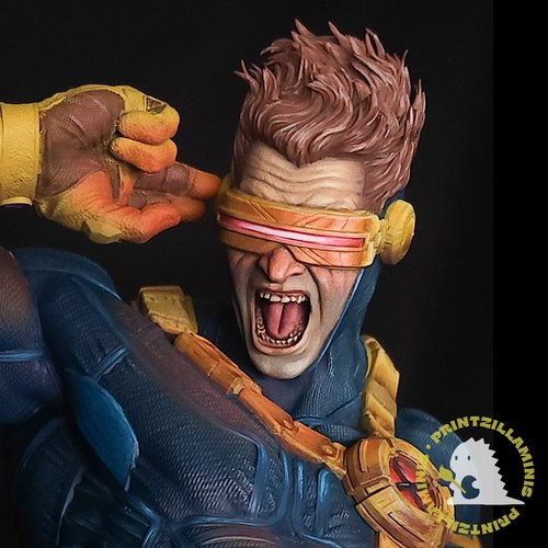 Cyclops